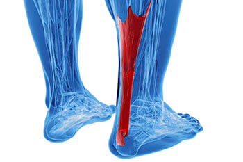 Achilles Tendonitis Treatment in the Dallas County, TX: Dallas (Garland, Richardson, Addison, Carrollton, Farmers Branch, University Park, Highland Park, Irving, Cockrell Hill, Duncanville, Hutchins, Lancaster, DeSoto, Cedar Hill, Grand Prairie, Glenn Heights) and Ellis County, TX: Red Oak, Oak Leaf, Ovilla areas