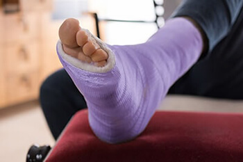 Foot Fractures treatment in the Dallas County, TX: Dallas (Garland, Richardson, Addison, Carrollton, Farmers Branch, University Park, Highland Park, Irving, Cockrell Hill, Duncanville, Hutchins, Lancaster, DeSoto, Cedar Hill, Grand Prairie, Glenn Heights) and Ellis County, TX: Red Oak, Oak Leaf, Ovilla areas